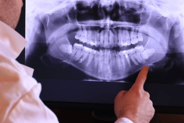 Best Emergency Treatment for Jaw Pain or Injury in Calverton, NY